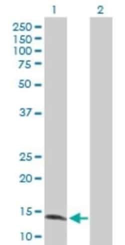 ZNF44 Antibody, Novus Biologicals 0.1 mg, Unconjugated:Antibodies, Polyclonal