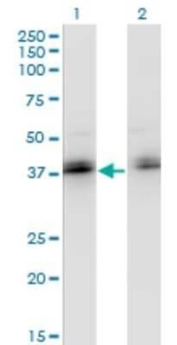 ZNF444 Antibody (4E9), Novus Biologicals 0.1 mg | Buy Online | Novus Biologicals | Fisher Scientific