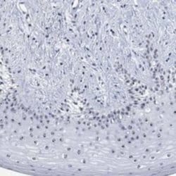 ZNF446 Rabbit anti-Human, Polyclonal, Novus Biologicals 100 &mu;g | Buy Online | Novus Biologicals | Fisher Scientific