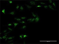 ZNF447 Antibody (2H1), Novus Biologicals 0.1 mg | Buy Online | Novus Biologicals | Fisher Scientific