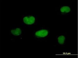 ZNF449 Antibody, Novus Biologicals 0.05 mg; Unconjugated:Antibodies, Polyclonal
