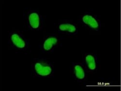 ZNF468 Antibody, Novus Biologicals 0.05 mg; Unconjugated:Antibodies, Polyclonal