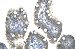 ZNF498 Rabbit anti-Human, Polyclonal, Novus Biologicals 0.1 mL; Unconjugated:Antibodies,