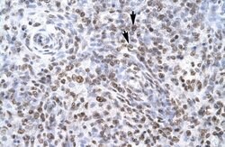 ZNF500 Antibody, Novus Biologicals 100 &mu;L; Unconjugated:Antibodies,