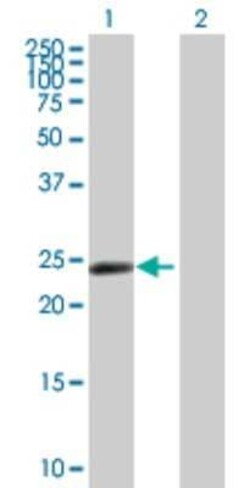 ZNF501 Antibody, Novus Biologicals 0.05 mg; Unconjugated:Antibodies, Polyclonal