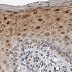 ZNF521 Antibody, Novus Biologicals 0.1 mL; Unconjugated:Antibodies, Polyclonal