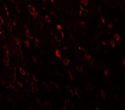 ZNF537 Antibody - BSA Free, Novus Biologicals 0.1 mg; Unconjugated:Antibodies,