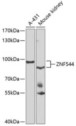 ZNF544 Antibody - BSA Free, Novus Biologicals:Antibodies:Primary Antibodies