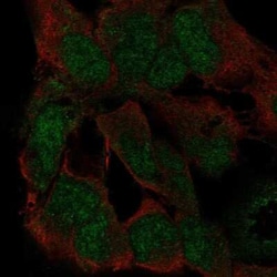 ZNF545 Antibody, Novus Biologicals 25ul; Unconjugated:Antibodies, Polyclonal