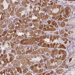 ZNF547 Antibody, Novus Biologicals:Antibodies:Primary Antibodies