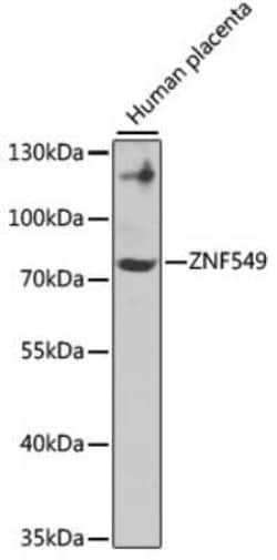 ZNF549 Antibody - BSA Free, Novus Biologicals 0.02 mL, Unconjugated:Antibodies,