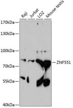 ZNF551 Antibody - Azide and BSA Free, Novus Biologicals:Antibodies:Primary
