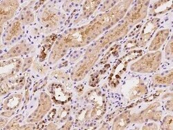 ZNF558 Antibody, Novus Biologicals:Antibodies:Primary Antibodies