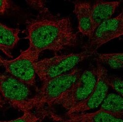 ZNF560 Antibody, Novus Biologicals:Antibodies:Primary Antibodies