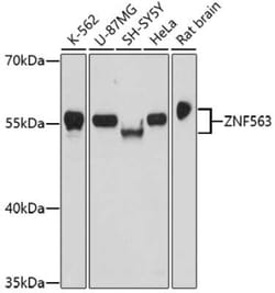 ZNF563 Antibody - Azide and BSA Free, Novus Biologicals:Antibodies:Primary