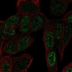 ZNF568 Rabbit anti-Human, Polyclonal, Novus Biologicals 25 &mu;g | Buy Online | Novus Biologicals | Fisher Scientific