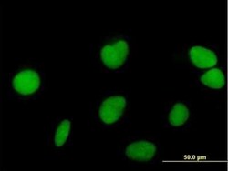ZNF573 Antibody, Novus Biologicals 0.05 mg; Unconjugated:Antibodies, Polyclonal
