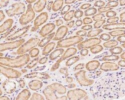 ZNF574 Antibody, Novus Biologicals:Antibodies:Primary Antibodies