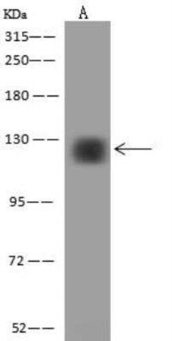 ZNF574 Antibody, Novus Biologicals:Antibodies:Primary Antibodies