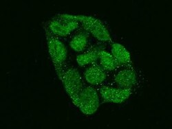 ZNF576 Antibody, Novus Biologicals 100 &mu;g, Unconjugated:Antibodies,
