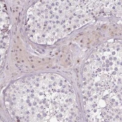 ZNF583 Antibody, Novus Biologicals 25 &mu;L, Unconjugated:Antibodies, Polyclonal