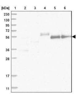 ZNF583 Antibody, Novus Biologicals 25 &mu;L, Unconjugated:Antibodies, Polyclonal