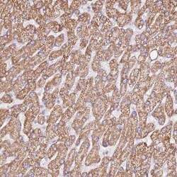 ZNF584 Antibody, Novus Biologicals:Antibodies:Primary Antibodies