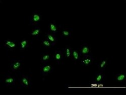 ZNF593 Antibody, Novus Biologicals 0.05 mg | Buy Online | Novus Biologicals | Fisher Scientific