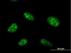 Novus Biologicals ZNF593 Antibody, Novus Biologicals 0.05 mg | Buy Online | Novus Biologicals&trade; | Fisher Scientific