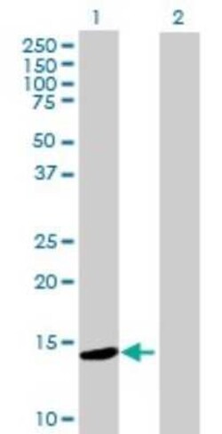 ZNF593 Antibody, Novus Biologicals 0.05 mg | Buy Online | Novus Biologicals | Fisher Scientific