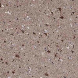 ZNF594 Rabbit anti-Human, Polyclonal, Novus Biologicals 25 &mu;g | Buy Online | Novus Biologicals | Fisher Scientific