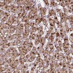 ZNF596 Antibody, Novus Biologicals 0.1 mL, Unconjugated:Antibodies, Polyclonal