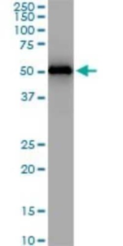 ZNF622 Antibody (4G6), Novus Biologicals 0.1 mg | Buy Online | Novus Biologicals | Fisher Scientific