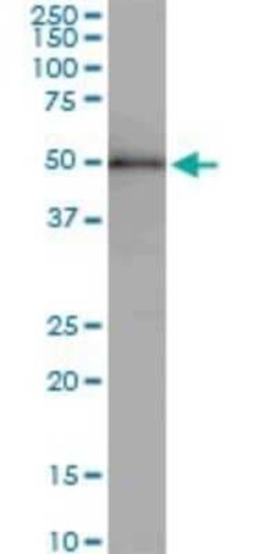 ZNF622 Antibody (4G6), Novus Biologicals 0.1 mg | Buy Online | Novus Biologicals | Fisher Scientific