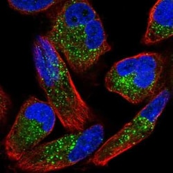 ZNF624 Antibody, Novus Biologicals 25 &mu;L, Unconjugated:Antibodies, Polyclonal