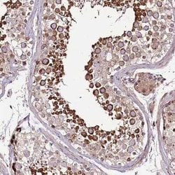 ZNF624 Antibody, Novus Biologicals 25 &mu;L, Unconjugated:Antibodies, Polyclonal