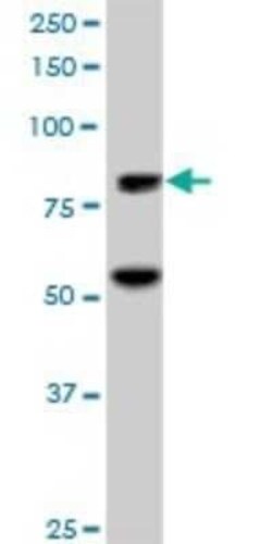 ZNF624 Antibody, Novus Biologicals 0.05 mg | Buy Online | Novus Biologicals | Fisher Scientific