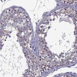 ZNF646 Antibody, Novus Biologicals:Antibodies:Primary Antibodies