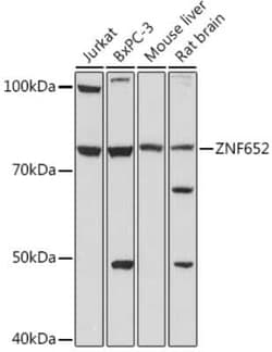 ZNF652 Rabbit anti-Human, Mouse, Rat, Polyclonal, Novus Biologicals 100 &mu;g | Buy Online | Novus Biologicals | Fisher Scientific