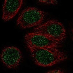 ZNF653 Antibody, Novus Biologicals:Antibodies:Primary Antibodies