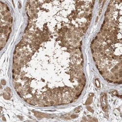 ZNF653 Antibody, Novus Biologicals:Antibodies:Primary Antibodies