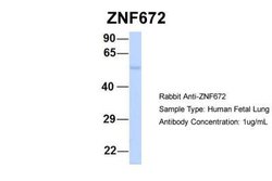 ZNF672 Antibody, Novus Biologicals 100 &mu;L; Unconjugated:Antibodies,