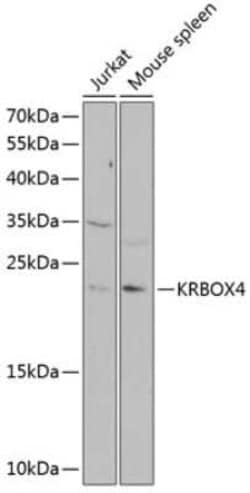 ZNF673 Antibody - BSA Free, Novus Biologicals:Antibodies:Primary Antibodies