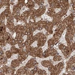 ZNF690 Antibody, Novus Biologicals 25 &mu;L; Unconjugated:Antibodies, Polyclonal