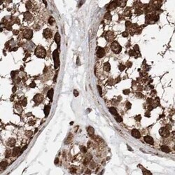 ZNF690 Antibody, Novus Biologicals 25 &mu;L; Unconjugated:Antibodies, Polyclonal