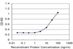 ZNF70 Antibody (1E3), Novus Biologicals 0.1 mg | Buy Online | Novus Biologicals | Fisher Scientific