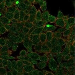 ZNF704 Mouse anti-Human, Clone: PCRP-ZNF704-3C10, Novus Biologicals:Antibodies:Primary
