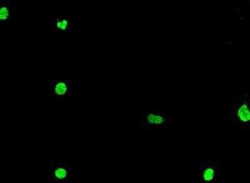 ZNF711 Antibody, Novus Biologicals 100 &mu;g; Unconjugated:Antibodies,