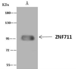 ZNF711 Antibody, Novus Biologicals 100 &mu;g; Unconjugated:Antibodies,