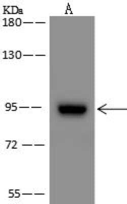 ZNF711 Antibody, Novus Biologicals 100 &mu;g; Unconjugated:Antibodies,